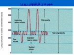 دانلود فایل پاورپوینت ICU صفحه 11 