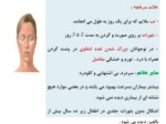 دانلود فایل پاورپوینت مراقبت بیماری سرخجه و سندرم سرخجه مادرزادی صفحه 3 