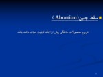 دانلود فایل پاورپوینت سقط جنین صفحه 2 