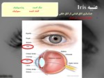 دانلود فایل پاورپوینت التهابات داخل چشمی صفحه 3 