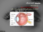 دانلود فایل پاورپوینت التهابات داخل چشمی صفحه 6 