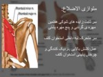 دانلود فایل پاورپوینت تحلیل حرکتی ناهنجاری شانه نابرابر صفحه 11 