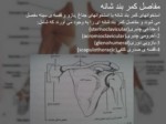 دانلود فایل پاورپوینت تحلیل حرکتی ناهنجاری شانه نابرابر صفحه 6 