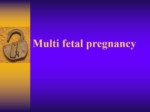 دانلود فایل پاورپوینت Multi fetal pregnancy صفحه 2 