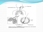 دانلود فایل پاورپوینت بیماریهای مزمن انسدادی ریه COPD صفحه 5 
