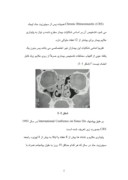 دانلود مقاله بررسی تأثیر قطره داخل بینی آمفوتریسین B در بهبود علایم بالینی مبتلایان به رینوسینوزیت مزمن در بیمارستانهای بوعلی صفحه 2 
