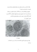 دانلود مقاله بررسی تأثیر قطره داخل بینی آمفوتریسین B در بهبود علایم بالینی مبتلایان به رینوسینوزیت مزمن در بیمارستانهای بوعلی صفحه 6 