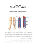 دانلود مقاله بیماری DVT چیست؟ صفحه 1 
